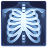 X ışını - Facebook