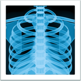 X-ray Emojisi U+1FA7B X-ray Emojisi U+1FA7B